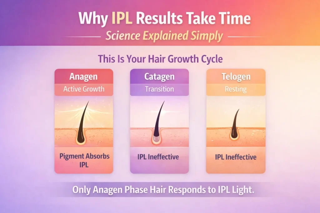 Why IPL Results Take Time